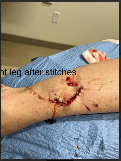 unnamed (3).png unnamed (3).png